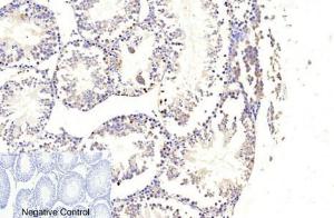 Immunohistochemical analysis of paraffin-embedded human testis tissue using Anti-Caspase 9 (cleaved Asp353) Antibody at 1:200 (4°C overnight). Negative control was secondary antibody only.