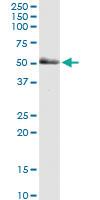 Anti-PAK2 Mouse Monoclonal Antibody [clone: 1E1]