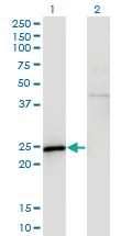 Anti-SPA17 Mouse Monoclonal Antibody [clone: 3B6]