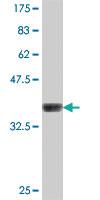 Anti-GKAP1 Mouse Polyclonal Antibody