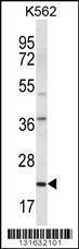 Anti-HLA-DQA1 Rabbit Polyclonal Antibody (AP (Alkaline Phosphatase))