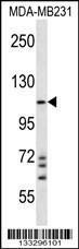 Anti-NLRC4 Rabbit Polyclonal Antibody (HRP (Horseradish Peroxidase))