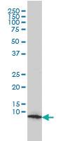 Anti-HSPE1 Mouse Monoclonal Antibody [clone: 4C11-B11]