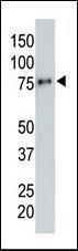 Anti-HA tag Mouse Monoclonal Antibody [clone: 12CA5]