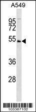 Anti-UHMK1 Rabbit Polyclonal Antibody (AP (Alkaline Phosphatase))