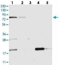 Anti-MTO1 Rabbit Polyclonal Antibody