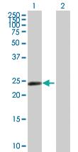 Anti-ZNF501 Mouse Polyclonal Antibody