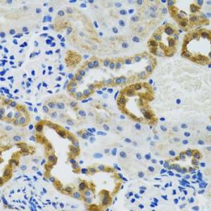 Immunohistochemistry analysis of paraffin-embedded mouse kidney using Anti-POLG2 Antibody (A9973) at a dilution of 1:100 (40x lens). Perform microwave antigen retrieval with 10 mM PBS buffer pH 7.2 before commencing with IHC staining protocol.