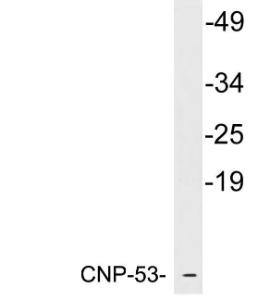 Western blot analysis of lysates from K562 cells using Anti-CNP-53 Antibody