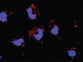 Anti-PAK2 Mouse Monoclonal Antibody [clone: 1E1]