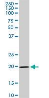 Anti-IL17D Rabbit Polyclonal Antibody