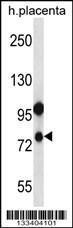 Anti-NLRP10 Rabbit Polyclonal Antibody (AP (Alkaline Phosphatase))