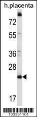 Anti-CCDC117 Rabbit Polyclonal Antibody (Biotin)