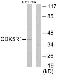 Western blot analysis of lysates from rat brain cells using Anti-CDK5R1 Antibody. The right hand lane represents a negative control, where the antibody is blocked by the immunising peptide