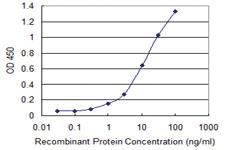 Anti-PAK2 Mouse Monoclonal Antibody [clone: 1E1]