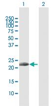 Anti-IL17D Rabbit Polyclonal Antibody