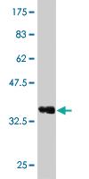 Anti-RCVRN Mouse Monoclonal Antibody [clone: 4E2]