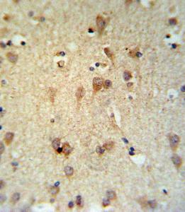 Anti-LCAT Rabbit Polyclonal Antibody (Biotin)