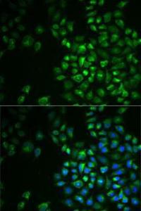 Immunofluorescence analysis of MCF7 cells using Anti-POLG2 Antibody (A9973). DAPI was used to stain the cell nuclei (blue).