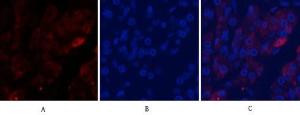 Immunofluorescence analysis of human stomach cancer tissue using Anti-Caspase 9 (cleaved Asp353) Antibody (red) at 1:200 (4°C overnight). Cy3 labelled secondary antibody was used at 1:300 (RT 50min). Panel A: Target. Panel B: DAPI. Panel C: Merge.