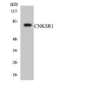 Western blot analysis of the lysates from HT 29 cells using Anti-CNKSR1 Antibody