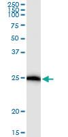 Anti-IL17D Rabbit Polyclonal Antibody