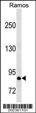 Anti-HGF Mouse Monoclonal Antibody [clone: 489CT6.12.6]