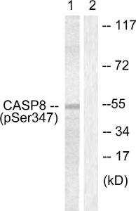 Western blot analysis of lysates from Jurkat cells using Anti-Caspase 8 (phospho Ser347) Antibody. The right hand lane represents a negative control, where the antibody is blocked by the immunising peptide.