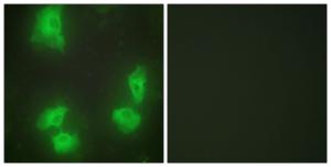 Immunofluorescence analysis of HeLa cells using Anti-CDK5R1 Antibody. The right hand panel represents a negative control, where the antibody was pre-incubated with the immunising peptide