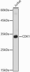 Western blot analysis of extracts of Jurkat cells, using Anti-CDK1 Antibody (A305460) at 1:1,000 dilution