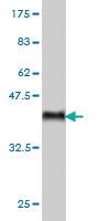 Anti-ARAF Mouse Monoclonal Antibody [clone: 5H8]