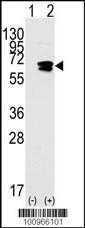 Anti-RAD9A Rabbit Polyclonal Antibody