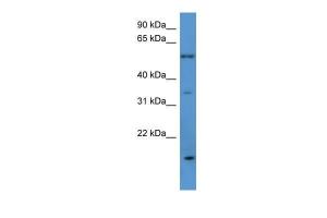 Anti-OR2J2 Rabbit Polyclonal Antibody