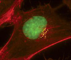 This antibody is suitable for all immunoassay applications. The optimal working dilution should be determined by the investigator.