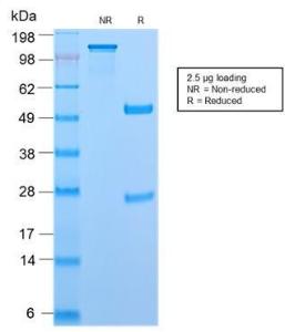 SDS-PAGE analysis of Anti-CD45RB Antibody [PTPRC/2877R] under non-reduced and reduced conditions; showing intact IgG and intact heavy and light chains, respectively. SDS-PAGE analysis confirms the integrity and purity of the Antibody