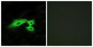 Immunofluorescence analysis of HeLa cells using Anti-MAS1L Antibody. The right hand panel represents a negative control, where the antibody was pre-incubated with the immunising peptide.