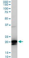 Anti-RHOC Mouse Monoclonal Antibody [clone: 1B7]