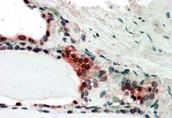 In paraffin embedded Human Thyroid Gland shows nclear and cytoplasm staining in activated epithelial cells Recommended concentration, 3-5 µg/ml