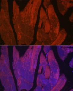 Immunofluorescence analysis of rat skeletal muscle cells using Anti-CACNA1S Antibody (A309295) at a dilution of 1:50 (40x lens). DAPI was used to stain the cell nuclei (blue)