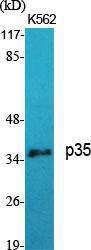 Western blot analysis of various cells using Anti-CDK5R1 Antibody