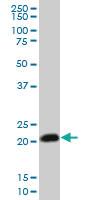 Anti-RHOC Mouse Monoclonal Antibody [clone: 1B7]