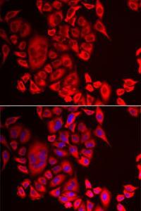 Immunofluorescence analysis of MCF-7 cells using Anti-Glutaminyl cyclase Antibody (A9977). DAPI was used to stain the cell nuclei (blue)