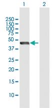 Anti-STOML2 Rabbit Polyclonal Antibody