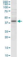 Anti-NUDT9 Mouse Polyclonal Antibody