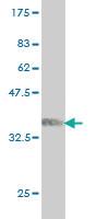 Anti-ARAF Mouse Monoclonal Antibody [clone: 3G2]