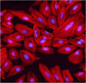 This antibody is suitable for all immunoassay applications. The optimal working dilution should be determined by the investigator.