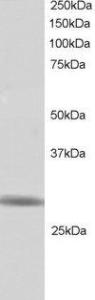 Anti-RNF141 Antibody (A83929) staining (1 µg/ml) of Human Testis lysate (RIPA buffer, 30 µg total protein per lane) Primary incubated for 1 hour Detected by western blot using chemiluminescence