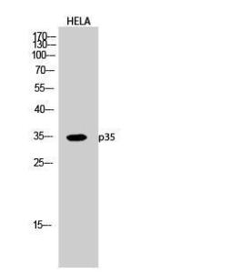 Western blot analysis of HELA cells using Anti-CDK5R1 Antibody