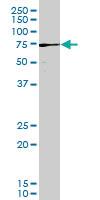 Anti-PAK3 Mouse Monoclonal Antibody [clone: 3A12]