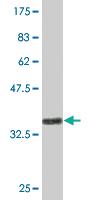 Anti-HSD17B7 Mouse Monoclonal Antibody [clone: 1G10]